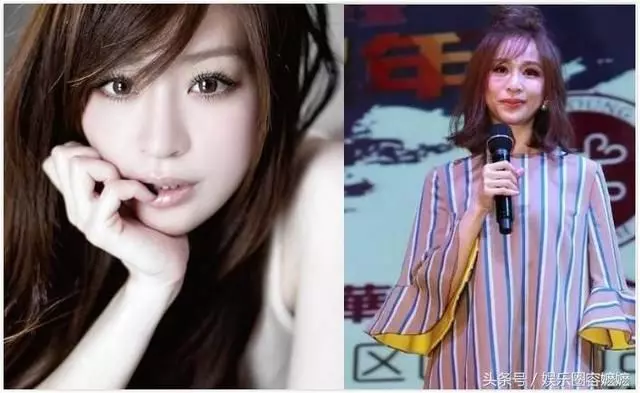 玻尿酸注射過量的女星們,李小璐臉上坑坑窪窪,王心凌直接認不出!