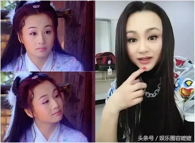 玻尿酸注射過量的女星們,李小璐臉上坑坑窪窪,王心凌直接認不出!