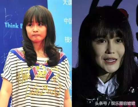玻尿酸注射過量的女星們,李小璐臉上坑坑窪窪,王心凌直接認不出!