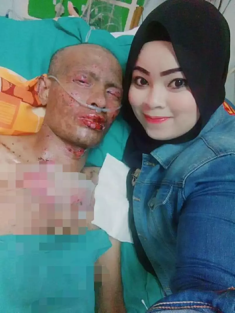 【不離不棄的真愛!!!】面對這樣的考驗不要抱怨,女子與丈夫的照片感動網民!女子:只希望他可以再見到我