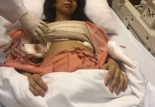 【超噁心】知名女歌手搭飛機「假乳」空中爆炸!胸部變黃色畸形塊!