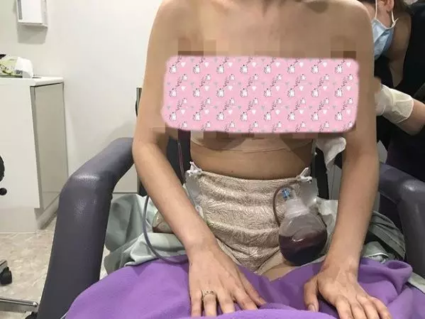 【超噁心】知名女歌手搭飛機「假乳」空中爆炸!胸部變黃色畸形塊!