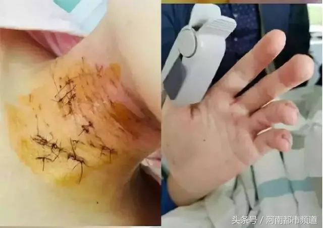 「比我漂亮的都得死!」13歲少女殺害閨蜜,兒童犯罪究竟罪在誰?