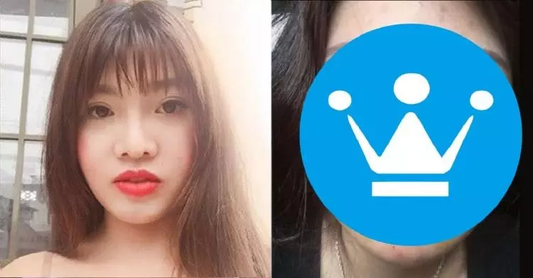 女花40萬整成正妹嫁富豪!一「失足」竟成千古恨...原形全都畢露啦!