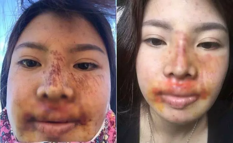 女花40萬整成正妹嫁富豪!一「失足」竟成千古恨...原形全都畢露啦!