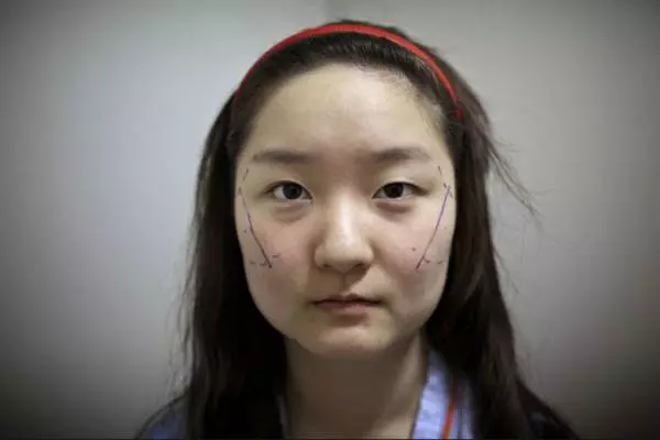韓國人造美女 整容背後心酸大公開