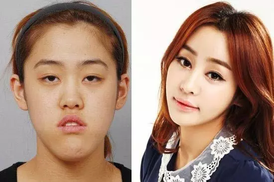 韓國人造美女 整容背後心酸大公開
