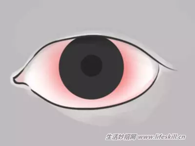 花一分鐘觀察一下眼睛,千萬不能輕忽了這10個症狀