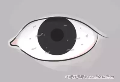 花一分鐘觀察一下眼睛,千萬不能輕忽了這10個症狀
