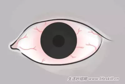 花一分鐘觀察一下眼睛,千萬不能輕忽了這10個症狀