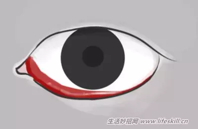 花一分鐘觀察一下眼睛,千萬不能輕忽了這10個症狀