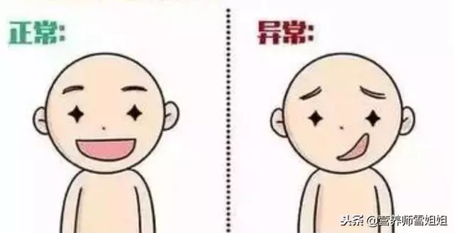 冬季,防腦卒中,8個「危險」信號,出現3個以上,最好去查查!