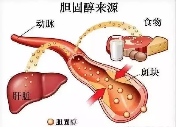 它是形成心腦血管疾病的元兇!但是它也有好的作用,控制好就可以