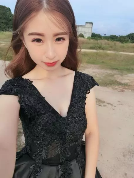 美女人妻生下4胞胎,代價是滿滿的「撕裂妊娠紋」!23歲辣媽: 「就算你有錢也沒辦法消除的痕跡」!