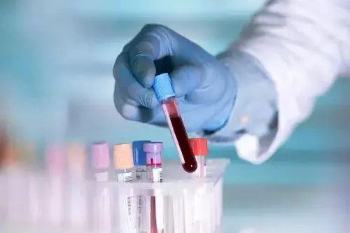 癌症其實是一種返祖現象?