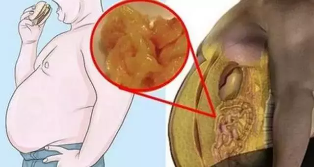 大大的肚子有超多脂肪?4招讓你減少「內臟脂肪含量」,恢復苗條身材