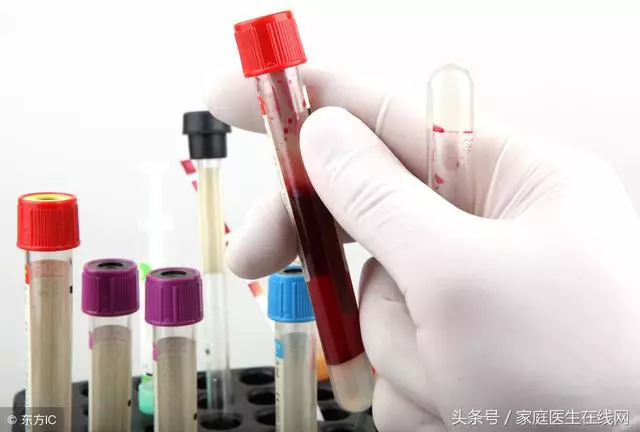 這3個表征在說明一件事,你的血液已經十分「粘稠」了