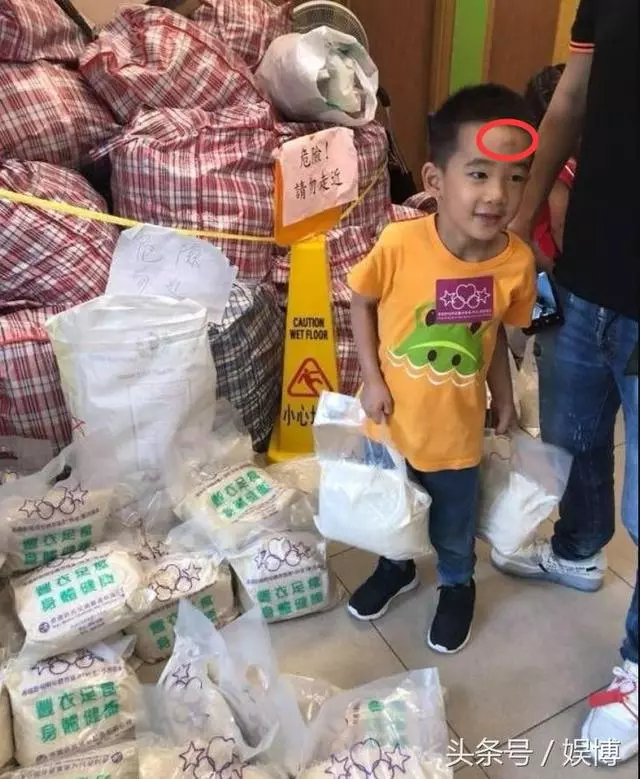 應采兒帶jasper做公益,jasper熱心幫助超感動,但他的額頭成焦點