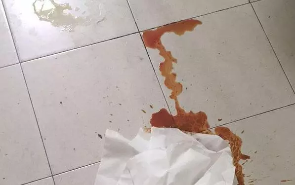 狗狗懷孕主人燉豬腳為它補身體,可第二天卻發現金毛吐血,主人崩潰大哭!