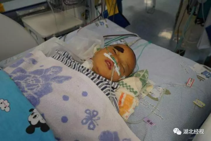 「爸爸,我不治了,給我買雙新鞋和一身新衣服就好。」 8歲女童被馬蜂群蜇,求家人放棄!…