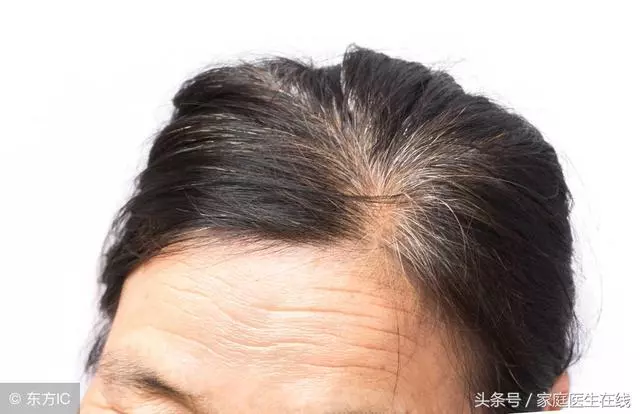 白髮日益增多,不妨多吃這2種食物,會有意外發現~