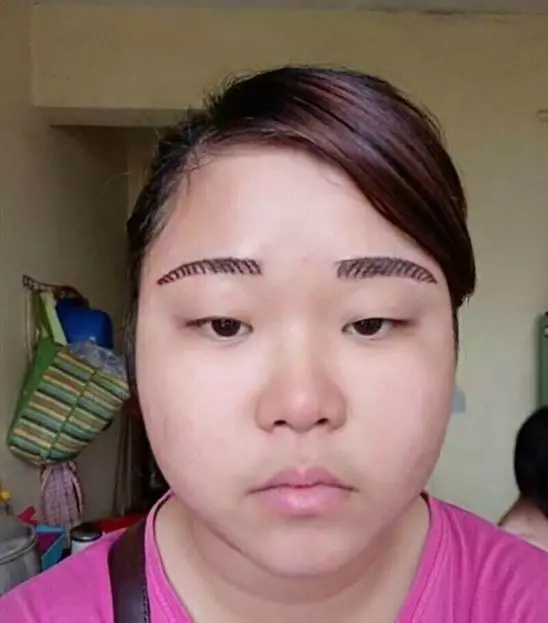 貪小便宜紋眉變兩顆「拜拜擲杯」,暖心醫生嘆不用錢:免費雷射送妳!