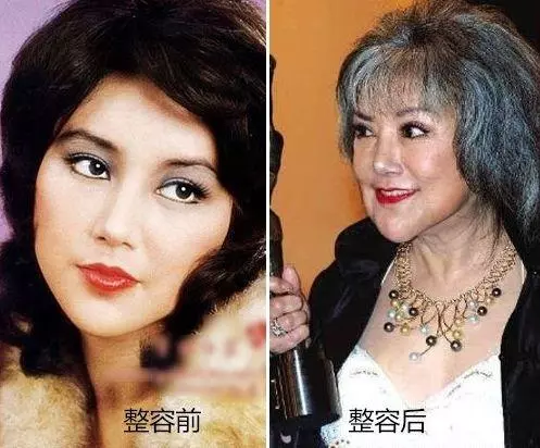 盤點整容失敗的女星:金喜善假體掉下來,而她半張臉徹底毀掉了!