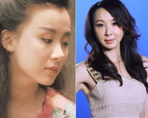 盤點整容失敗的女星:金喜善假體掉下來,而她半張臉徹底毀掉了!