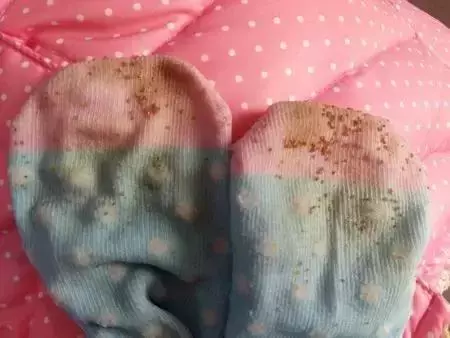 兩個月狗狗渾身黑點,主人接觸後身上奇癢無比