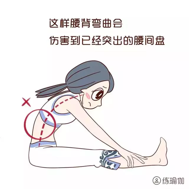 椎間盤突出症不能瞎鍛煉會致病,最全正確鍛煉方法,59萬人都在用!