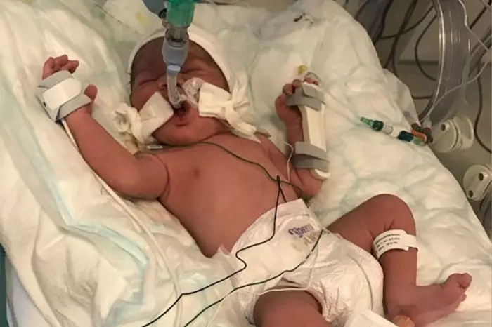 臨盆孕婦慘遭弩箭射死 醫生緊急剖腹救出胎兒 | 東方網 | 馬來西亞東方日報