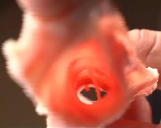 被魚刺卡住喝醋?當心要了你的命!