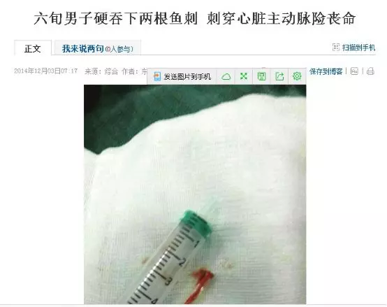 被魚刺卡住喝醋?當心要了你的命!