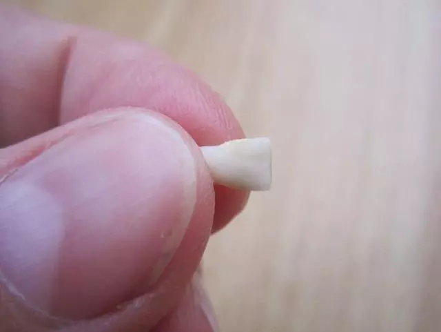 醫生:孩子乳牙掉了別再傻傻丟掉,儲存下來能救命!