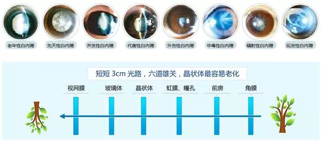 3種植物泡水喝,巧治眼疲勞、老花眼!