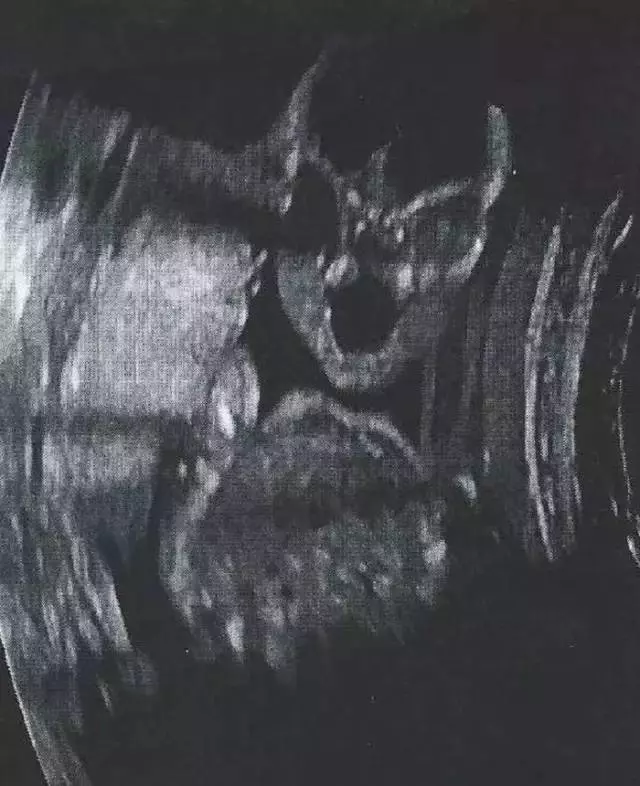21張暗網流出真實恐怖照片,看得我毛骨悚然!