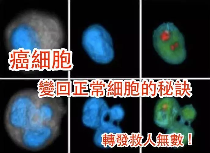 1 年內治好癌症!讓癌細胞「變回」正常細胞的秘訣!