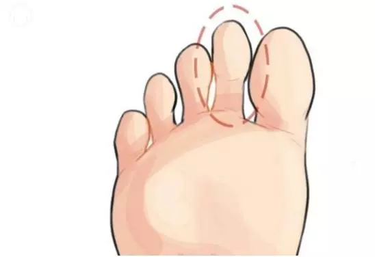 心理測試:你的哪個腳趾最長?測出你十年後的社會地位