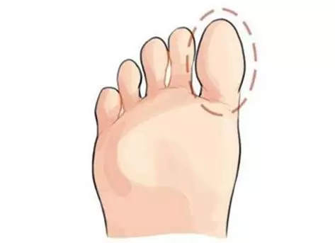 心理測試:你的哪個腳趾最長?測出你十年後的社會地位