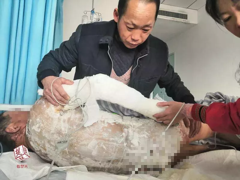 八十大壽殺豬慶賀 老漢竟被掙扎的豬踢進開水鍋裡
