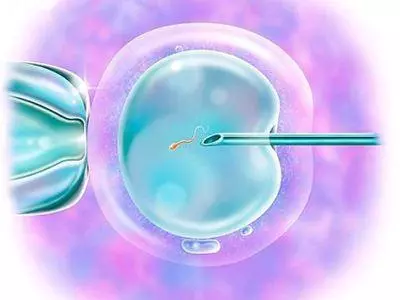為什麼明星很容易就能懷上「雙胞胎」?兩種「慣用方法」....但一般女人都不願接受!