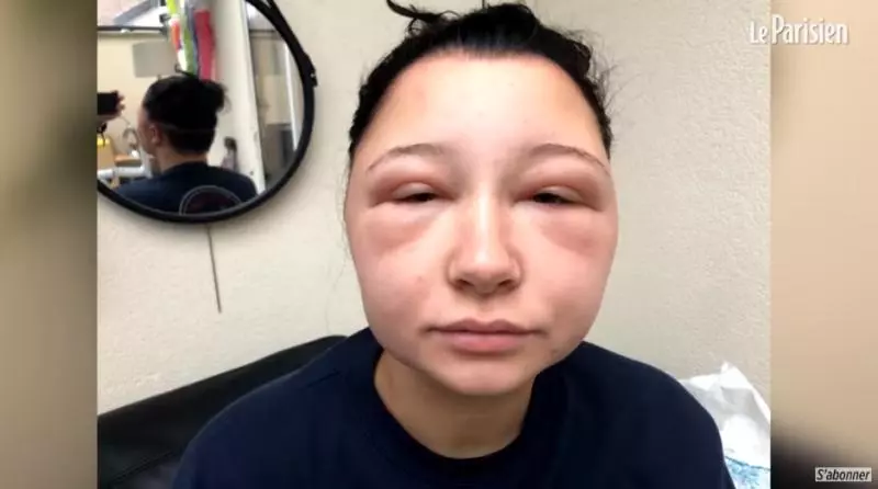 正妹染髮變異形!毀容慘變「燈泡頭」瀕死 真相嚇壞