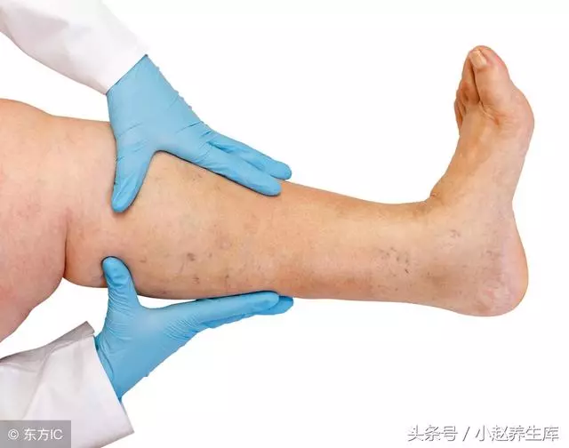 三處血管堵的十大表現,若一個都不占,說明你的「血管」還算健康