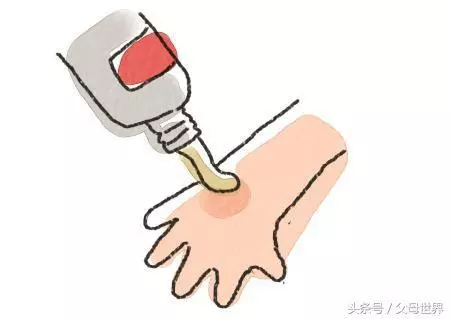 孩子燙傷後,最佳治療時間只有2分鐘,你知道該怎麼做嗎