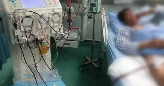 身體不適亂試「降火偏方」 男肝腎衰竭險身亡