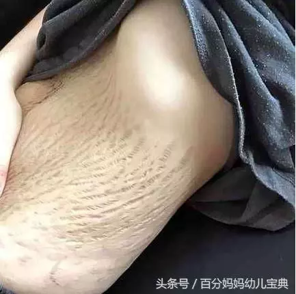 90後辣媽生下四胞胎,幾年後撩開衣服,網友頓時嚇出一身冷汗!