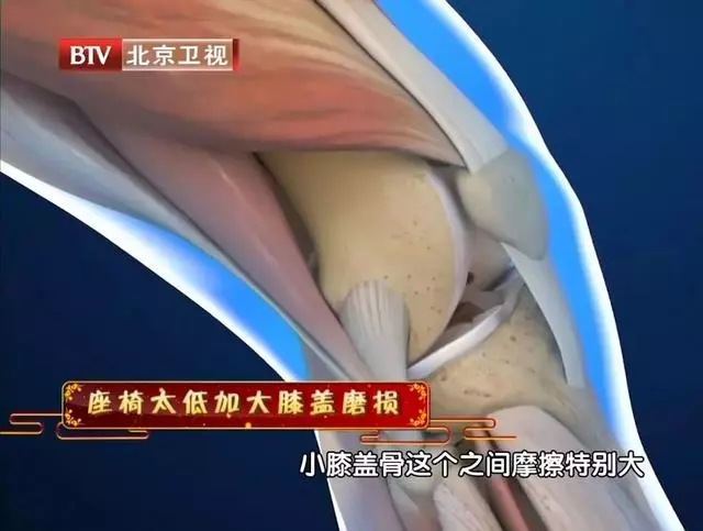 毀腰、毀膝蓋、致腿疼,你天天做的這個動作,骨科專家從不做!
