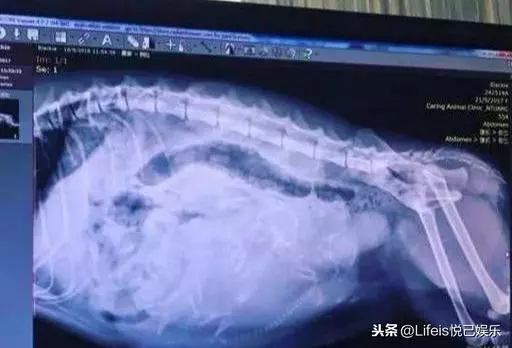 張柏芝終現身!大墨鏡遮憔悴神情,手腕醫用膠帶暴露三胎真假!