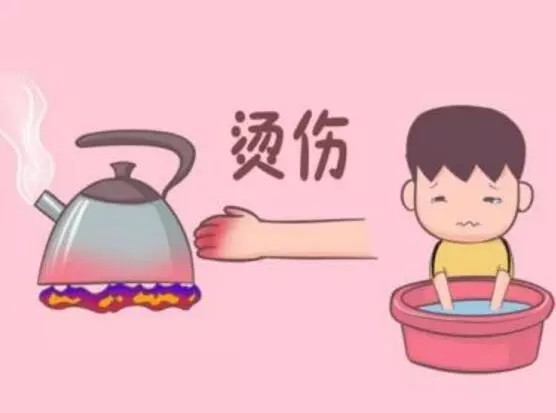 孩子燙傷後,最佳治療時間只有2分鐘,這3步燙傷的急救法,媽媽一定要知道!