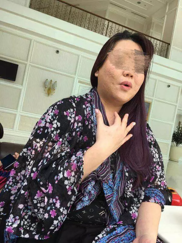 大馬「水腫姐」冒充美女,和男網民見面還撒了「史上最瞎謊言」繼續騙他。網民:「一夜腫20kg的難度真高,佩服!」